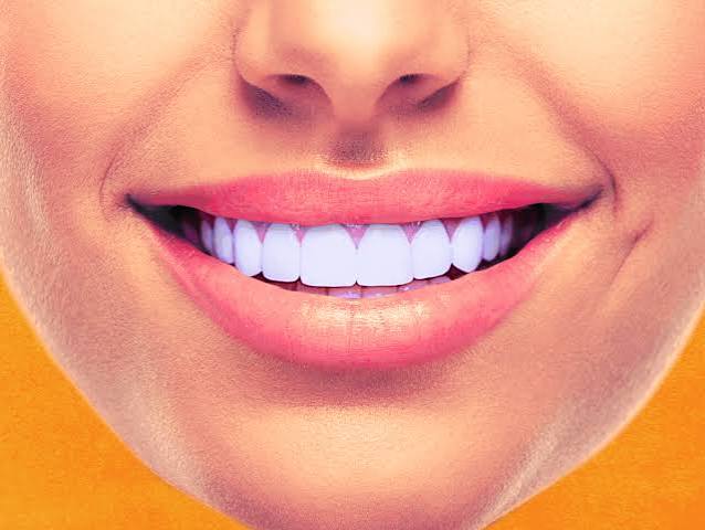 The Case That Already Has Veneers